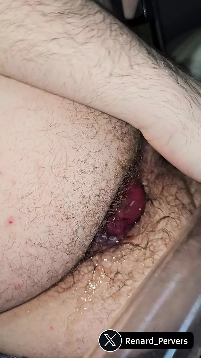 First Time I Pump My Prolapse Free Gay Porn 2d XHamster