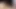 Masturbating sitting on prolapse