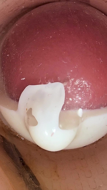 Thrilling moment from "The Camera in the Deep Pussy Records a Huge Ejaculation of Sperm Into the Condom"