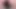 anal01
