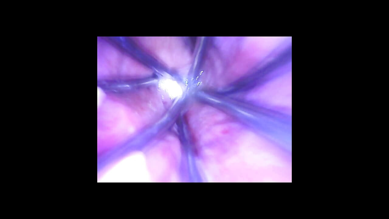Speculum & Microcamera cho Lady Soniac
