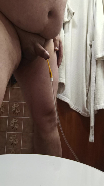 Homem se masturbando com sonda foley inserida.