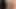 I Showed My Penis To My Best Friend - Her Honest Reaction