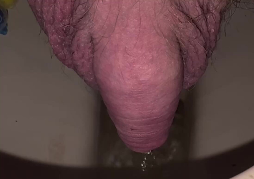 I urgently needed to pee