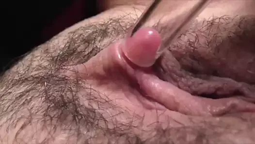 Stimulation du clitoris avec un tube à vide pulsatile