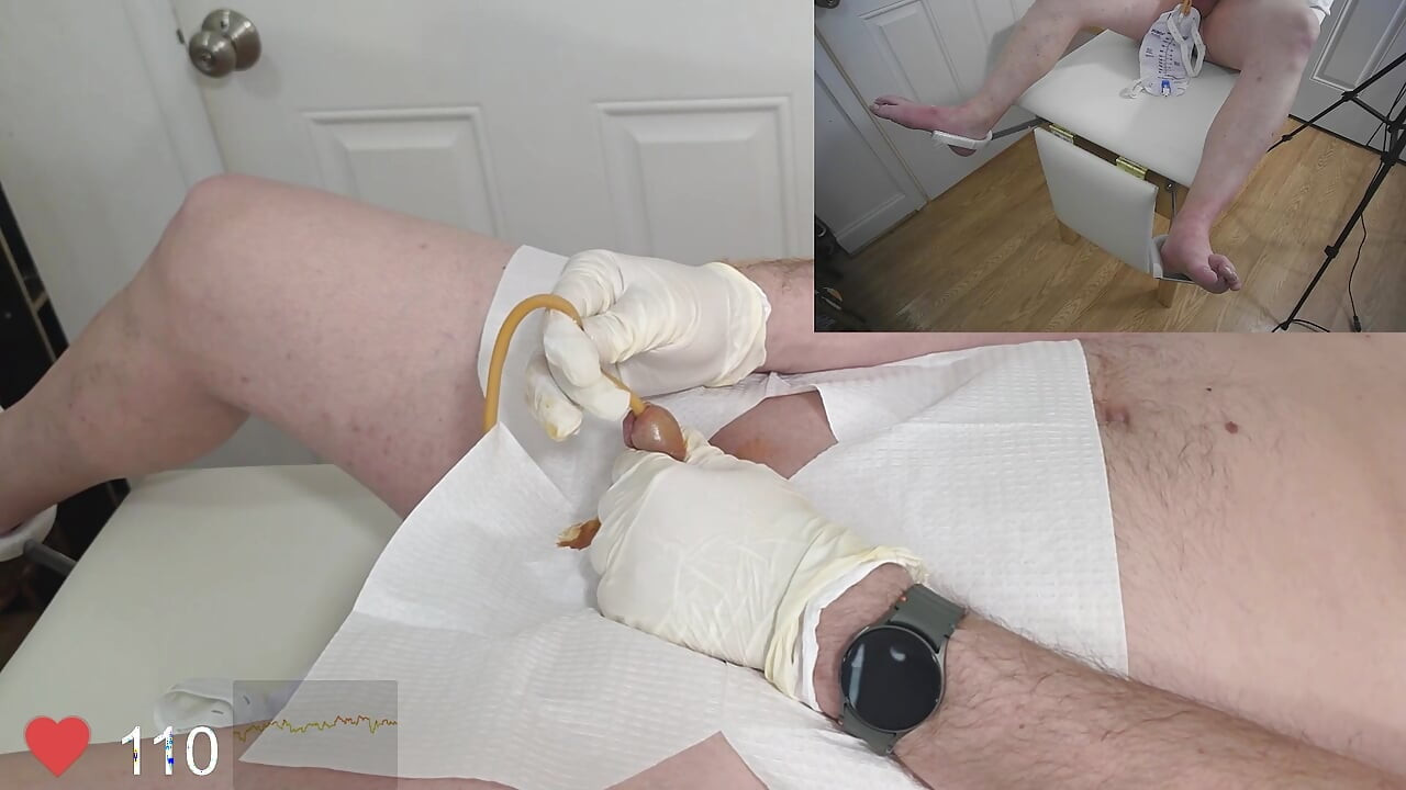 Foley 导尿管和膀胱填充