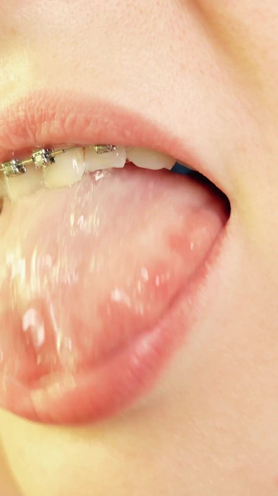 Powerful moment from "braces mouth tour video - vore fetish"
