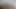 Lizzy Yum - Just SHAVING #1 Post-op Orgasm Pussy Clit Masturbation Teasing Orgasm
