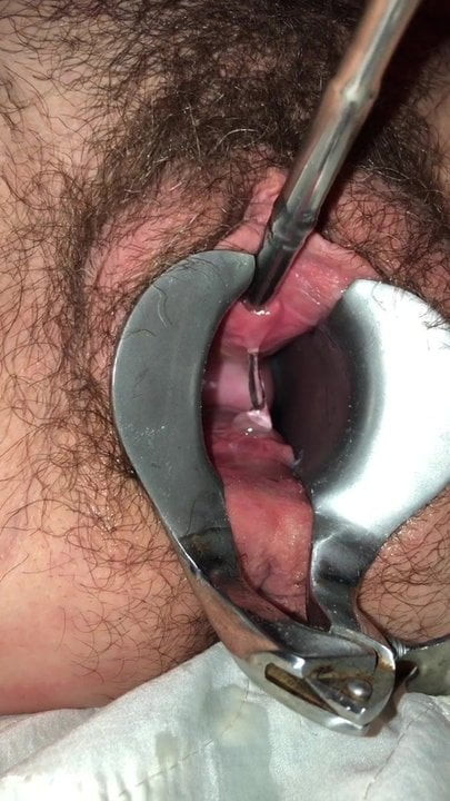 Urethral 10mm