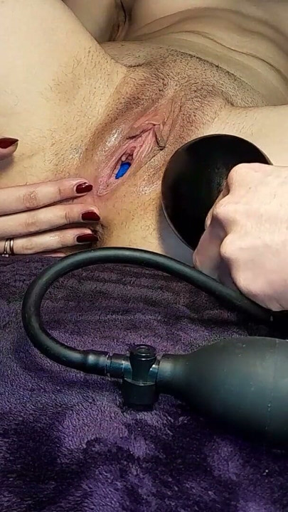 I tear my with an inflator along with the balloon | Clip 1
