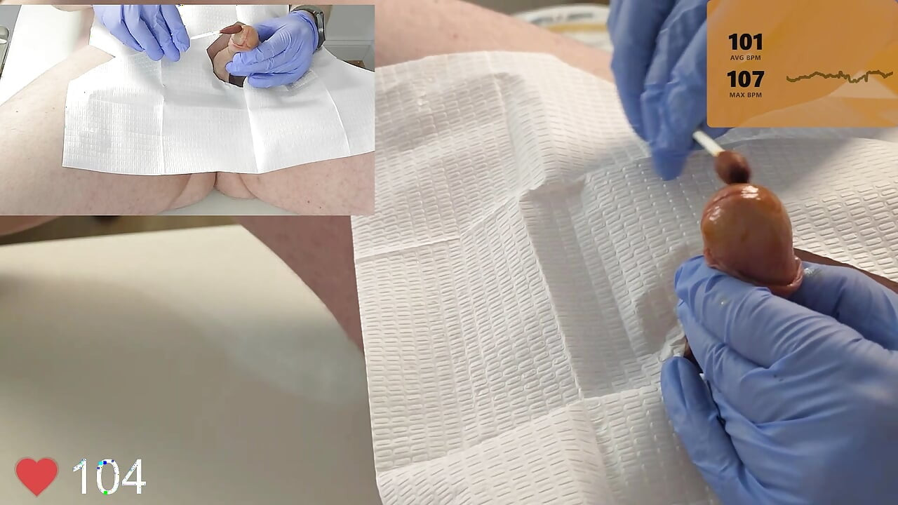 20 French Foley Catheter Insertion
