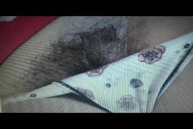 hair-lich2