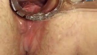 BBW opened up with speculum