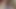 Rüya : kıllı koltuk altı 15