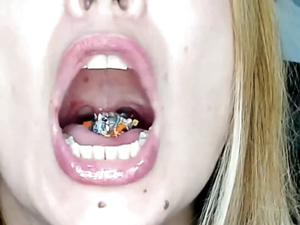 Endoscopia!! Gigante engoliu 25 membros ao mesmo tempo