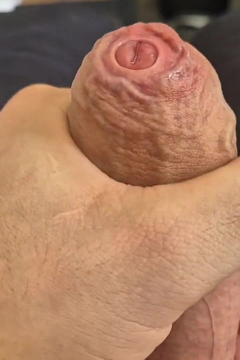 Tight Uncut Phimosis Cock Stretched Close up! Raw Foreskin Play