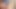 Foreskin movement (slowmotion) 500