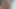 Lizzy Yum SD August 2025 Dilating #33