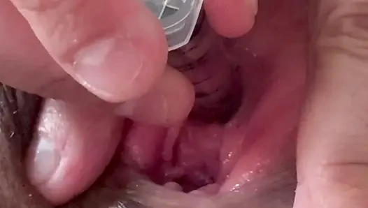 Pissloch-dehnen