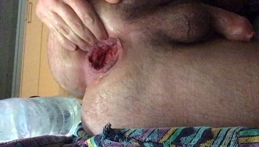 Italian bottle in ass fisting and prolapse and piss and cumming