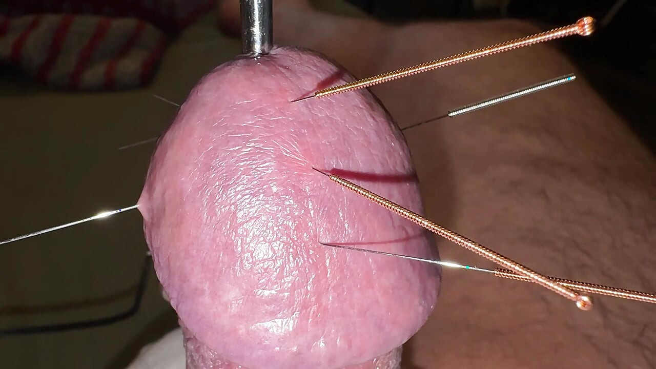 Acupuncture - Orgasme!