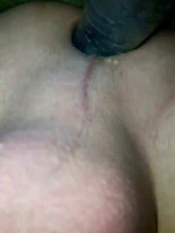 Prostatamassage
