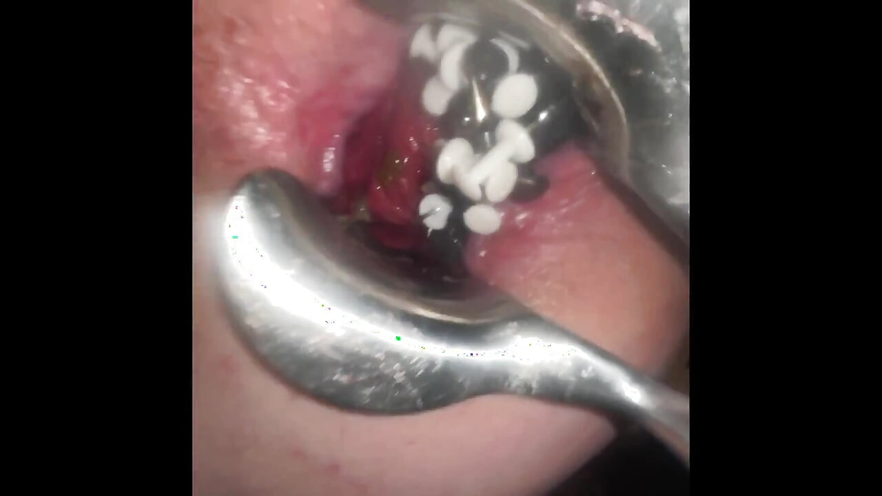 Nipple and anal torment with thumbtacks