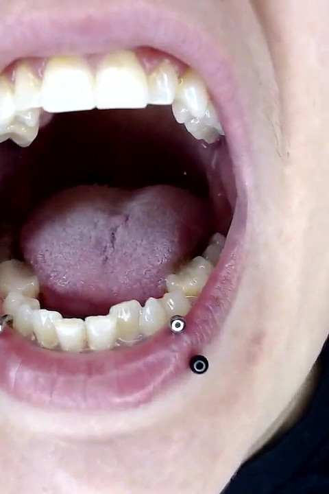 Big Wide Inside Both Girls Mouths
