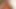 Cn topless 4