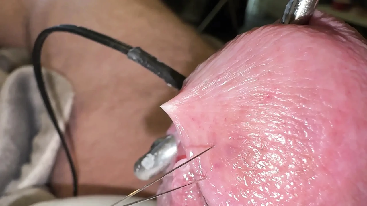 Ouch… but it’s very cool!