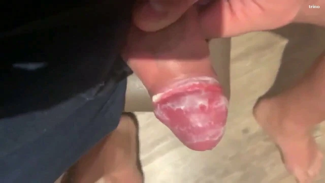 Smegma ???
