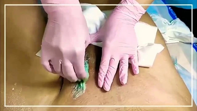 Sugaring For Men – Brazilian Depilation