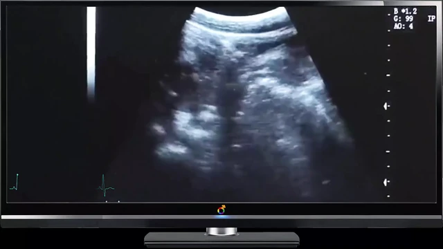 Daddy Ultrasound Deep Fuck
