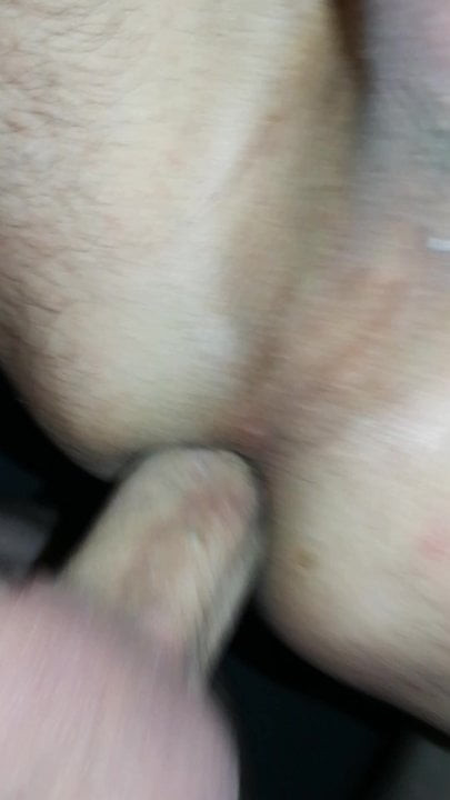 Anal