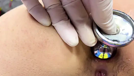 Memperbesar anus istriku menjadi 4cm