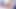 Interracial Anal: 30cm Black Cock in Tight White Ass - Extreme Contrasts