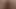 Anal
