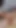 Unforgettable moment from "Sounding His Dick With A Huge 30 Cm Dilator. Cum Blocking, No Cumming Till I Decide, Femdom Mistress"