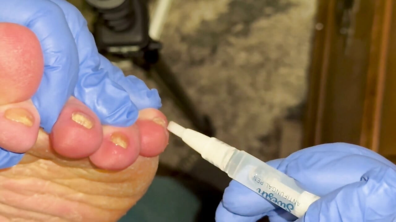 Crusty Foot Care and Worship - FTM