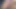 Hairy Micro Penis Getting Erection With Cumshot