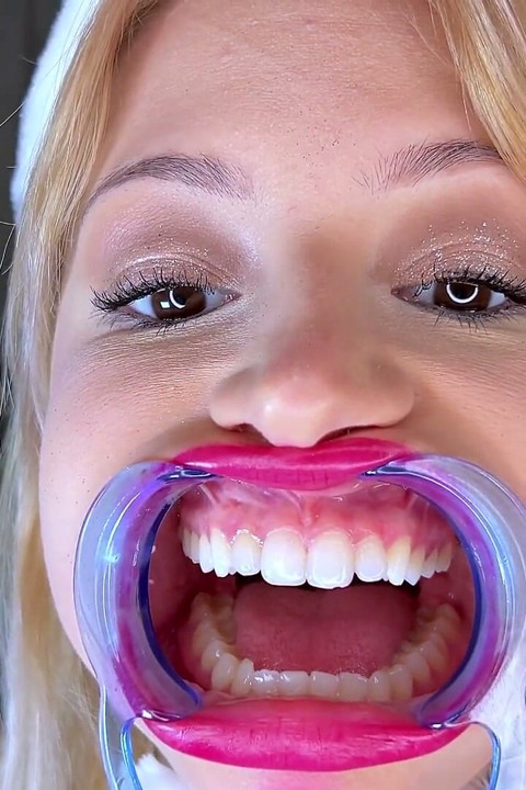 Mouth Retractor Teeth Examination