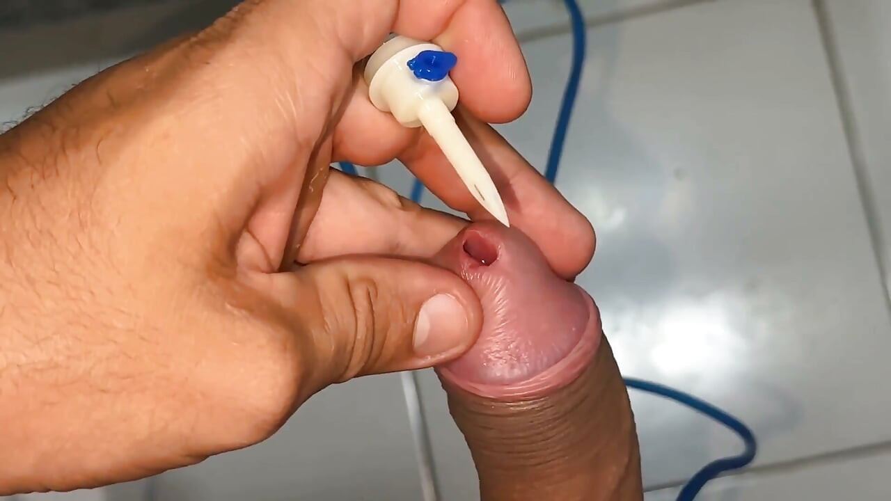 Üretral Kanalda aşırı Keskin Bir Sondaj Yapıyor.