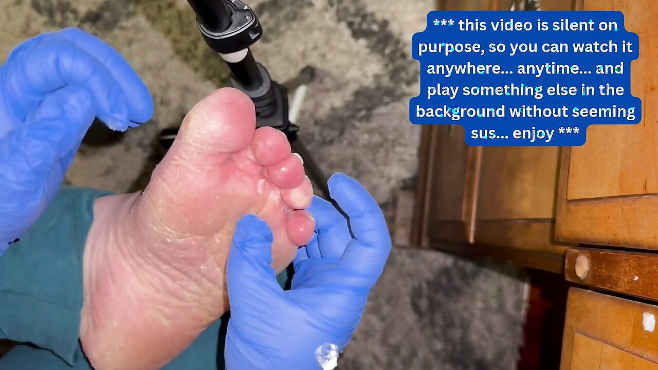 Crusty Foot Care and Worship - FTM