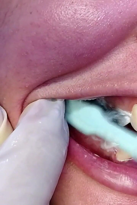 تنظيف أسناني بالفرشاة وإظهار أسناني (لقطة قريبة)