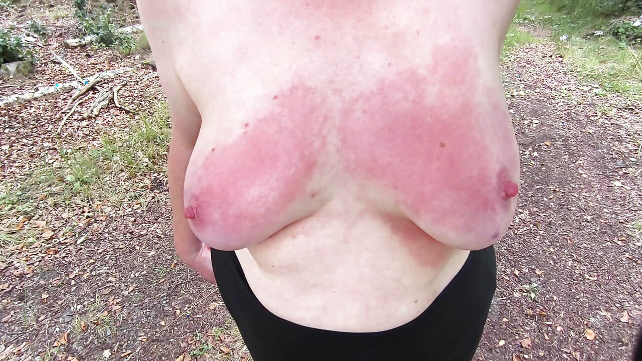 Barefoot beating your breasts red while hiking