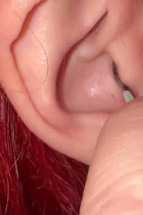 Cleaning Ear Wax
