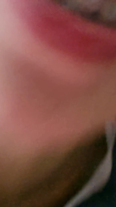 Kisssss You