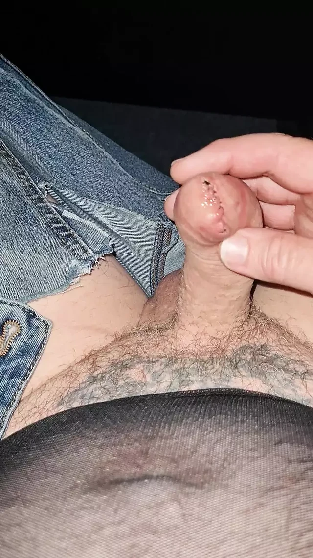 Sewn foreskin