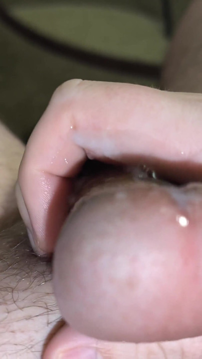 After snow and frost, I warm up with hot water and rubbing | Clip 2