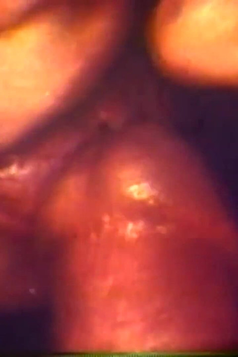 नर्सें मरीज की देखभाल करती हैं